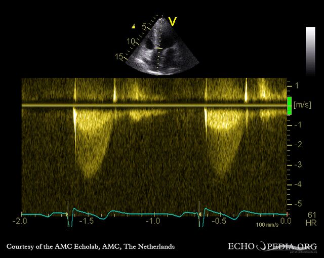 File:E00388.jpg - Echopedia