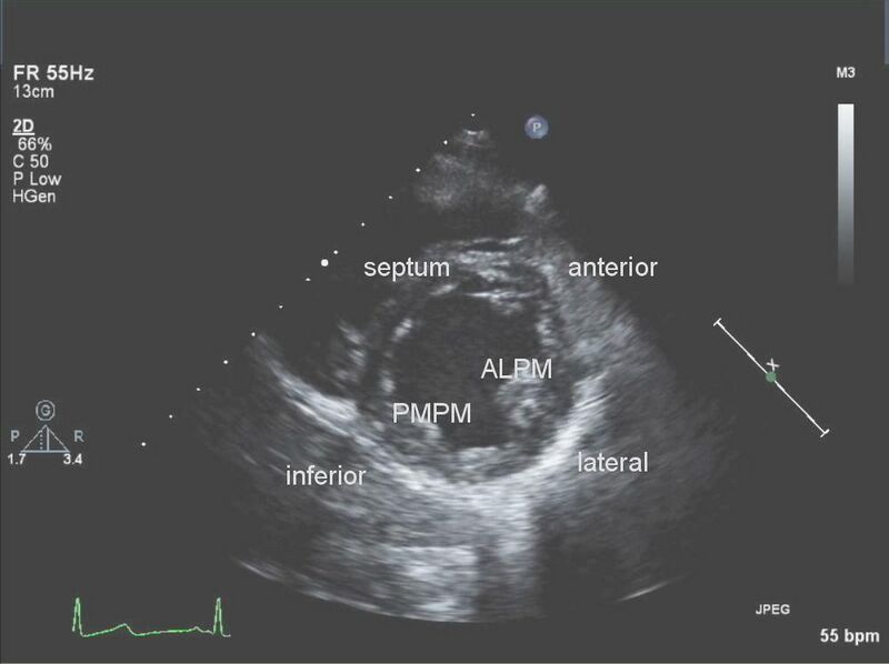 File:BasicsOfImagingFig11.jpg