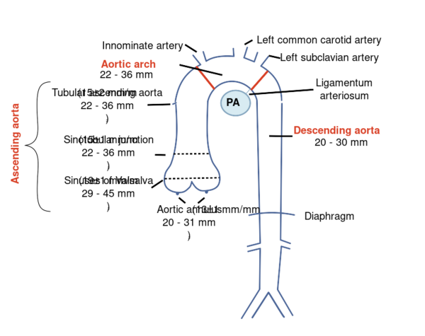 Aorta Echopedia