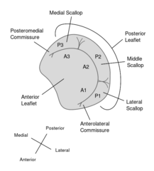 File:TEE mitral valve.svg - ECHOpedia